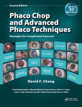 Phaco Chop and Advanced Phaco Techniques - Chang, David F.