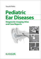 Pediatric Ear Diseases - Y. Naito