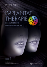 Implantattherapie: Der integrierte Behandlungsplan - Mauro Merli
