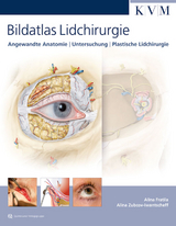 Bildatlas Lidchirurgie - Alina Fratila, Alina Zubcov-Iwantscheff