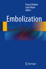 Embolization - 