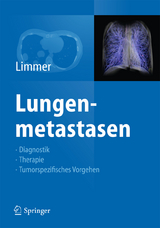 Lungenmetastasen - 