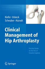 Clinical Management of Hip Arthroplasty -  Hartmuth Kiefer