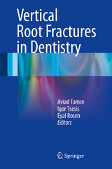 Vertical Root Fractures in Dentistry - 
