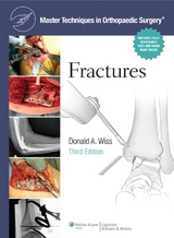 Master Techniques in Orthopaedic Surgery: Fractures - Wiss, Donald