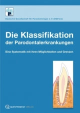 Die Klassifikationen der Parodontalerkrankungen - 