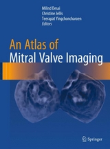 An Atlas of Mitral Valve Imaging - 