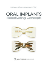 Oral Implants - 