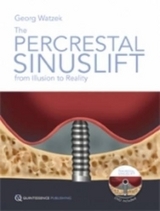 The Percrestal Sinuslift - George Watzek