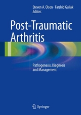 Post-Traumatic Arthritis - 