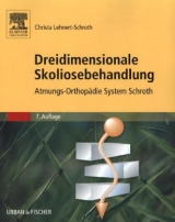 Dreidimensionale Skoliosebehandlung - Lehnert-Schroth, Christa