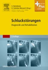 Schluckstörungen - Bartolome, Gudrun; Schröter-Morasch, Heidrun