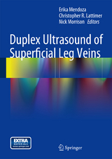 Duplex Ultrasound of Superficial Leg Veins - 