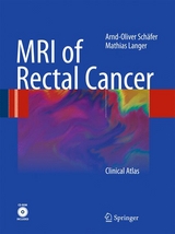 MRI of Rectal Cancer -  Arnd-Oliver Schäfer,  Mathias Langer