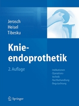 Knieendoprothetik -  Jörg Jerosch,  Jürgen Heisel,  Carsten Tibesku
