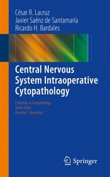 Central Nervous System Intraoperative Cytopathology - César R. Lacruz, Javier Saénz de Santamaría, Ricardo H. Bardales