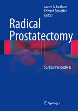 Radical Prostatectomy - 