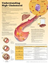 Understanding High Cholesterol Lam - Moodie, Douglas S.