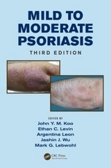 Mild to Moderate Psoriasis - Koo, John; Levin, Ethan; Leon, Argentina; Wu, Jashin; Lebwohl, Mark