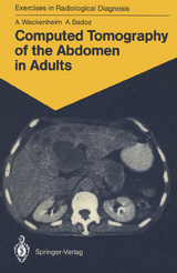 Computed Tomography of the Abdomen in Adults - Auguste Wackenheim, Armelle Badoz