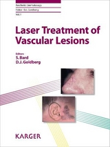 Laser Treatment of Vascular Lesions - 