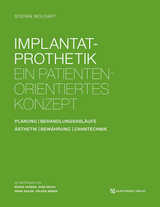 Implantatprothetik - Stefan Wolfart