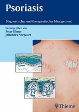 Psoriasis -  Peter Elsner,  Johannes Norgauer