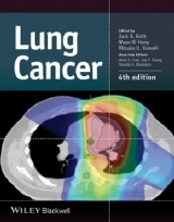 Lung Cancer - Roth, Jack A.; Hong, Waun Ki; Komaki, Ritsuko U.