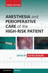 Anesthesia and Perioperative Care of the High-Risk Patient - McConachie, Ian