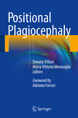 Positional Plagiocephaly - 