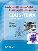 Endobronchial Ultrasound-Guided Transbronchial Needle Aspiration (EBUS-TBNA): A Practical Approach - 