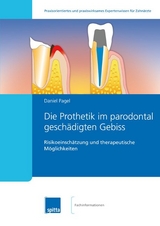 Die Prothetik im parodontal geschädigten Gebiss - Daniel Pagel