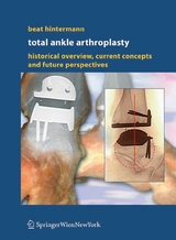 Total Ankle Arthroplasty -  Beat Hintermann