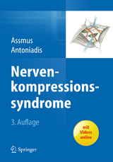 Nervenkompressionssyndrome - 