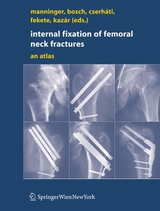 Internal fixation of femoral neck fractures -  Jenö Manninger,  Ulrich Bosch,  Peter Cserhati