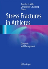 Stress Fractures in Athletes - 
