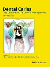 Dental Caries - Fejerskov, Ole; Nyvad, Bente; Kidd, Edwina A. M.