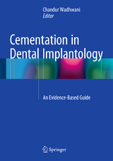 Cementation in Dental Implantology - 