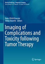 Imaging of Complications and Toxicity following Tumor Therapy - 