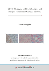 CD34+ Fibrozyten im Stroma benigner und maligner Tumoren der Glandula parotidea - Tobias Langguth