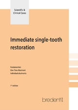 Immediate single tooth restoration