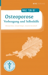Osteoporose - Michael Elies, Eckard Krüger, Annette Kerckhoff