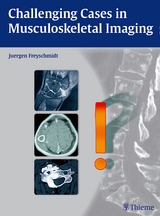 Challenging Cases in Musculoskeletal Imaging - Jürgen Freyschmidt