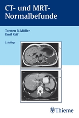 CT und MRT Normalbefunde - Möller, Torsten Bert; Reif, Emil