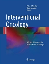 Interventional Oncology - 