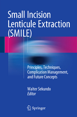 Small Incision Lenticule Extraction (SMILE) - 