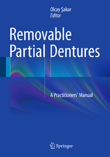 Removable Partial Dentures - 