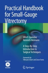 Practical Handbook for Small-Gauge Vitrectomy - Ulrich Spandau, Heinrich Heimann