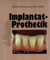 Implantat-Prothetik - Wolfram Bücking, Ralf Suckert