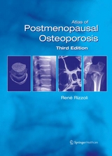 Atlas of Postmenopausal Osteoporosis - 